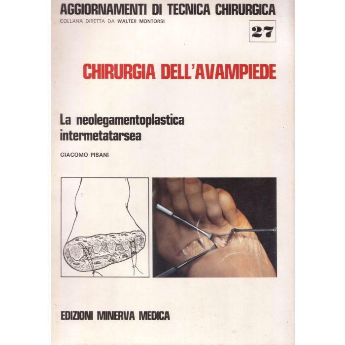 chirurgia-dell-avampiede-la-neolegamentoplastica-intermetatarsea-pisani-minerva-medica chirurgia-dell-avampiede-la-neolegamentoplastica-intermetatarsea-pisani-minerva-medica