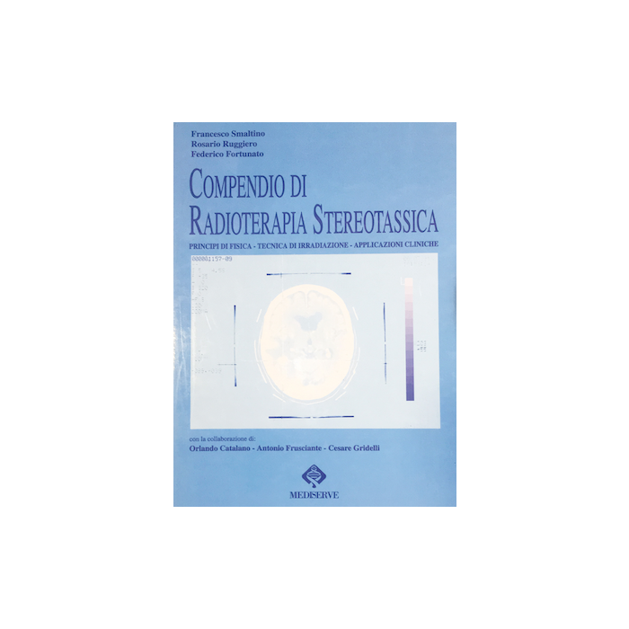 Radioterapia Stereotassica Radioterapia Stereotassica