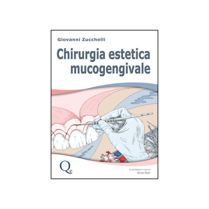 Chirurgia Estetica Mucogengivale Zucchelli Giovanni quintessenza edizioni