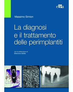 La diagnosi e il trattamento delle perimplantiti - Massimo Simion - Edra Elsevier Masson - 9788821440106