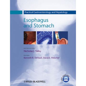 Practical Gastroenterology and Hepatology: Esophagus and Stomach  Talley Nicholas J.; DeVault Kenneth R.; Fleischer David E. Wiley - Blackwell  9781405182737