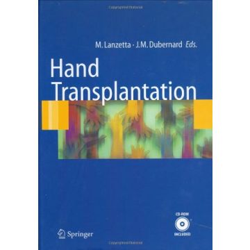 Hand Transplantation. Con Cd-rom - Lanzetta M. ; Dubernard J. M.  - Springer Verlag Italia - 9788847003736