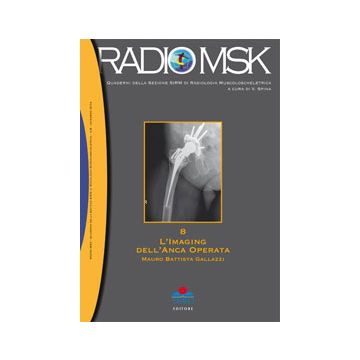 radio-msk-quaderni-della-sezione-sirm-di-radiologia-muscoloscheletrica-l-imaging-dell-anca-operata-gallazzi-timeo-editore-9788897162490