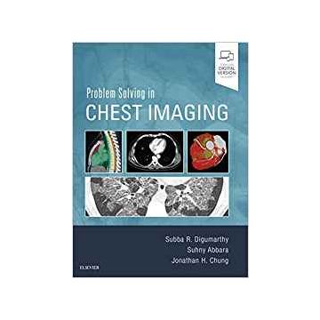 Problem Solving in Chest Imaging