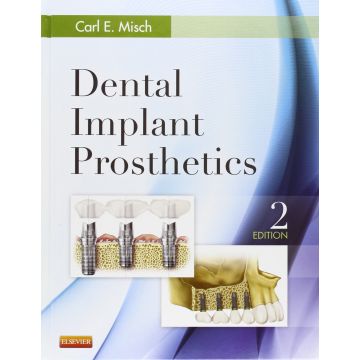 Dental Implant Prosthetics, 2nd Edition     [Misch - Elsevier Science]