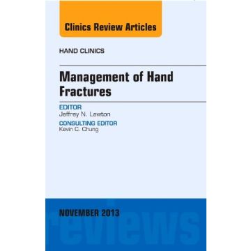 Management of Hand Fractures, An Issue of Hand Clinics