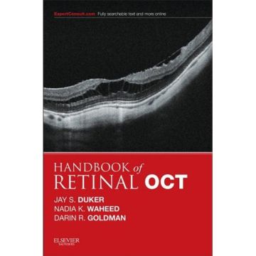 Handbook of Retinal OCT: Optical Coherence Tomography - Expert Consult: Online and Print