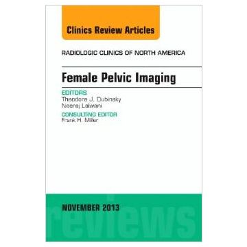 Female Pelvic Imaging, An Issue of Radiologic Clinics of North America