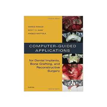 Computer-Guided Applications for Dental Implants, Bone Grafting, and Reconstructive Surgery (adapted translation), 1st Edition   [Rinaldi - Elsevier Science]