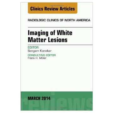 Imaging of White Matter, An Issue of Radiologic Clinics of North America