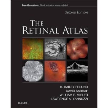 The Retinal Atlas, 2nd Edition   [Freund - Elsevier Science]