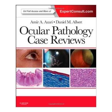 Ocular Pathology Case Reviews - Expert Consult - Online and Print