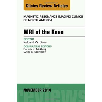 MRI of the Knee, An Issue of Magnetic Resonance Imaging Clinics of North America   [Davis - Elsevier Science]