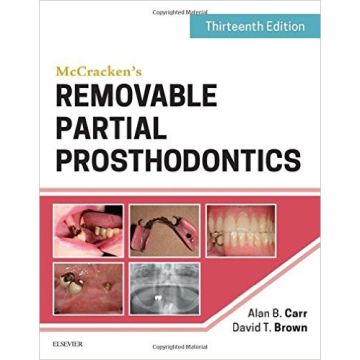 McCracken's Removable Partial Prosthodontics , 13th Edition    [Carr - Elsevier Science]