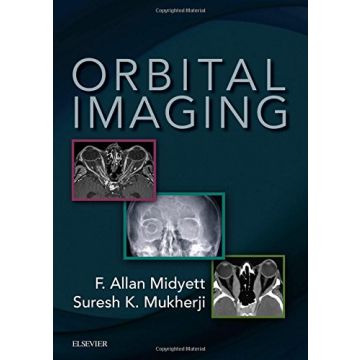 Orbital Imaging   [Midyett - Elsevier Science]