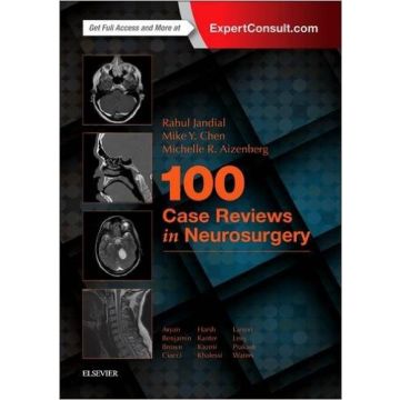 100 Case Reviews in Neurosurgery    [Jandial - Elsevier Science]