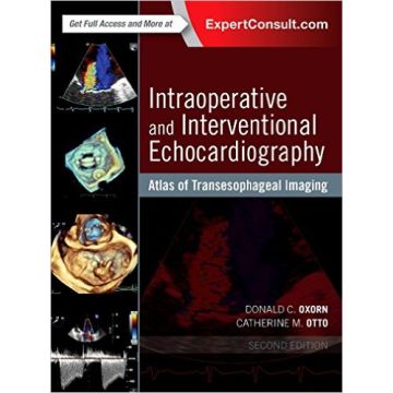Intraoperative and Interventional Echocardiography, 2nd Edition - Atlas of Transesophageal Imaging    [Oxorn - Elsevier Science]