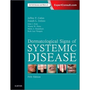 Dermatological Signs of Systemic Disease, 5th Edition     [Callen - Elsevier Science]