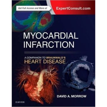 Myocardial Infarction: A Companion to Braunwald's Heart Disease    [Morrow - Elsevier Science]