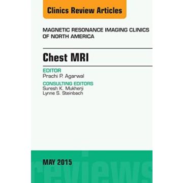 Chest MRI, An Issue of Magnetic Resonance Imaging Clinics of North America, Volume 23-2