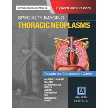 Specialty Imaging: Thoracic Neoplasms, 1st Edition         [Rosado-de-Christenson - Elsevier Science]