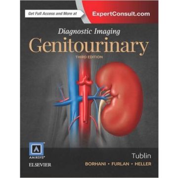 Diagnostic Imaging: Genitourinary, 3rd Edition   [Tublin - Elsevier Science]