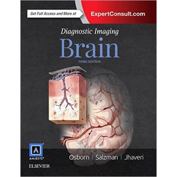 Diagnostic Imaging: Brain, 3rd Edition    [Osborn - Elsevier Science]