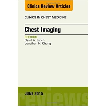 Chest Imaging, An Issue of Clinics in Chest Medicine, 1st Edition   [Lynch - Elsevier Science]