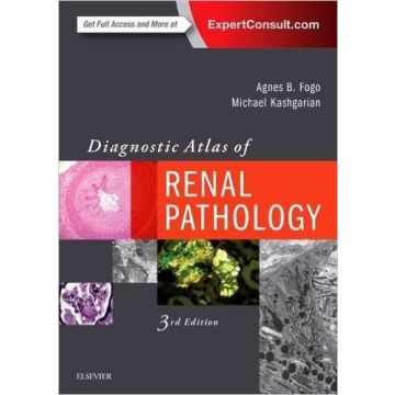 Diagnostic Atlas of Renal Pathology, 3rd Edition     [Fogo - Elsevier Science]