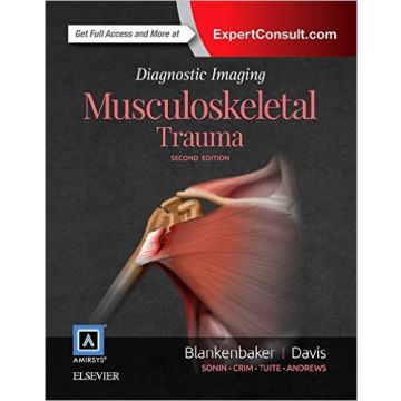 Diagnostic Imaging: Musculoskeletal Trauma, 2nd Edition    [Blankenbaker - Elsevier Science]