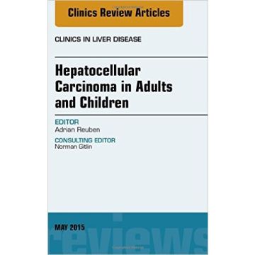 Hepatocellular Carcinoma in Adults and Children, An Issue of Clinics in Liver Disease, 1st Edition    [Reuben - Elsevier Science]