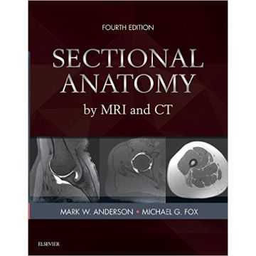Sectional Anatomy by MRI and CT, 4th Edition   [Anderson - Elsevier Science]