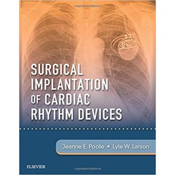 Poole Larson Surgical Implantation of Cardiac Rhythm Devices
