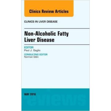 Non-Alcoholic Fatty Liver Disease, An Issue of Clinics in Liver Disease, Volume 20-2    [Gaglio - Elsevier Science]