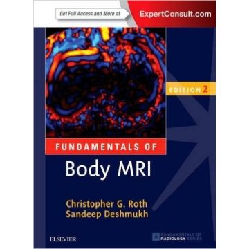 Fundamentals of Body MRI, 2nd Edition    [Roth - Elsevier Science]