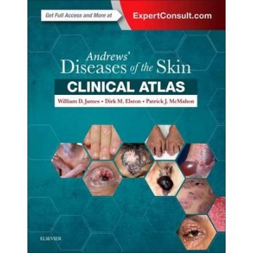Andrews' Diseases of the Skin Clinical Atlas
