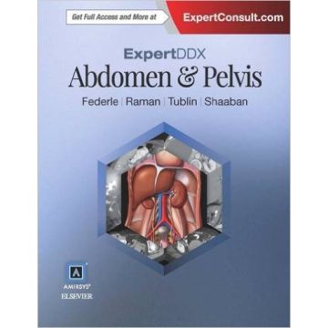 ExpertDDx: Abdomen and Pelvis, 2nd Edition    [Federle - Elsevier Science]