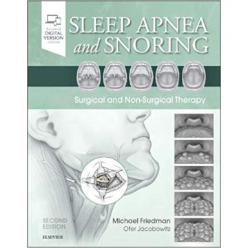 Sleep Apnea and Snoring, 2nd Edition . Surgical and Non-Surgical Therapy