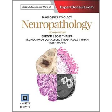 Diagnostic Pathology: Neuropathology, 2nd Edition     [Kleinschmidt-DeMasters - Elsevier Science]