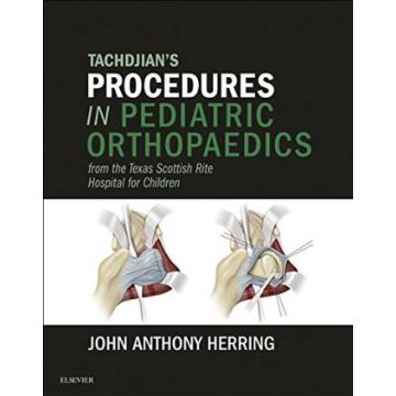 Tachdjian's Procedures in Pediatric Orthopaedics - From the Texas Scottish Rite Hospital for Children    [Herring - Elsevier Science]