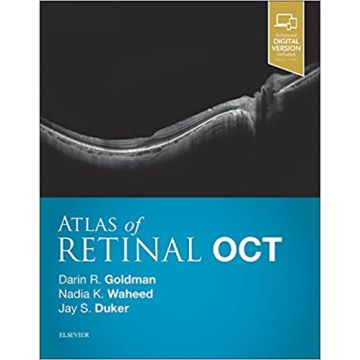 Atlas of Retinal OCT: Optical Coherence Tomography       [Goldman - Elsevier Science]