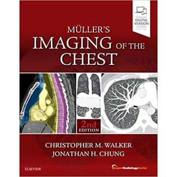 Muller's Imaging of the Chest, 2nd Edition - Expert Radiology Series