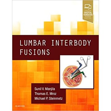 Lumbar Interbody Fusions