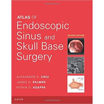 Atlas of Endoscopic Sinus and Skull Base Surgery, 2nd Edition