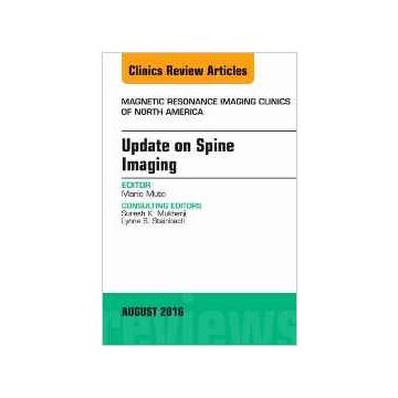 Update on Spine Imaging, An Issue of Magnetic Resonance Imaging Clinics of North America, Volume 24-3   [Muto - Elsevier Science]