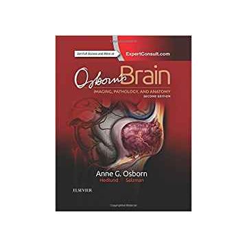 Osborn's Brain, 2nd Edition