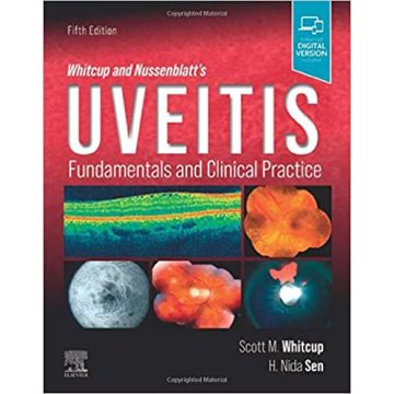 Whitcup and Nussenblatt's Uveitis, 5th Edition - Fundamentals and Clinical Practice