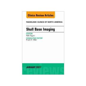 Skull Base Imaging, An Issue of Radiologic Clinics of North America, Volume 55-1    [Aygun - Elsevier Science]