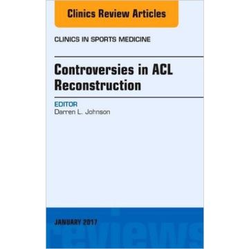 Controversies in ACL Reconstruction, An Issue of Clinics in Sports Medicine, Volume 36-1   [Johnson - Elsevier Science]