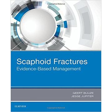 Scaphoid Fractures - Evidence-Based Management